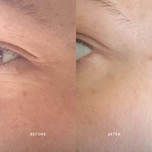 Bioactive Renewal Eye Creme (10 ml)
