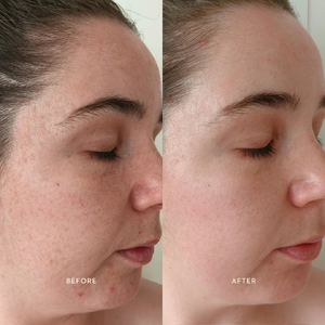 Bioactive Renewal Night Serum (5 ml)