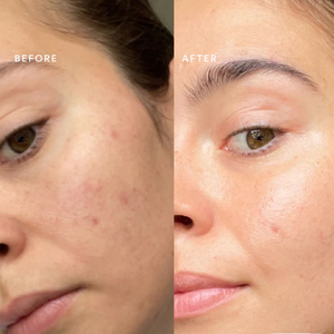 Clear Skin (150 g)