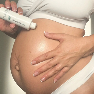 Vitamin A + E Stretch Mark Oil (120 ml)