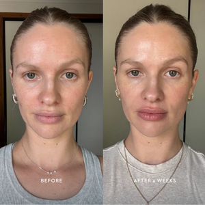 Bioactive Renewal Night Serum (5 ml)
