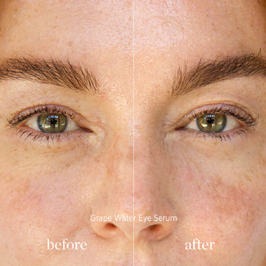 Grape Water Eye Serum (8 ml)