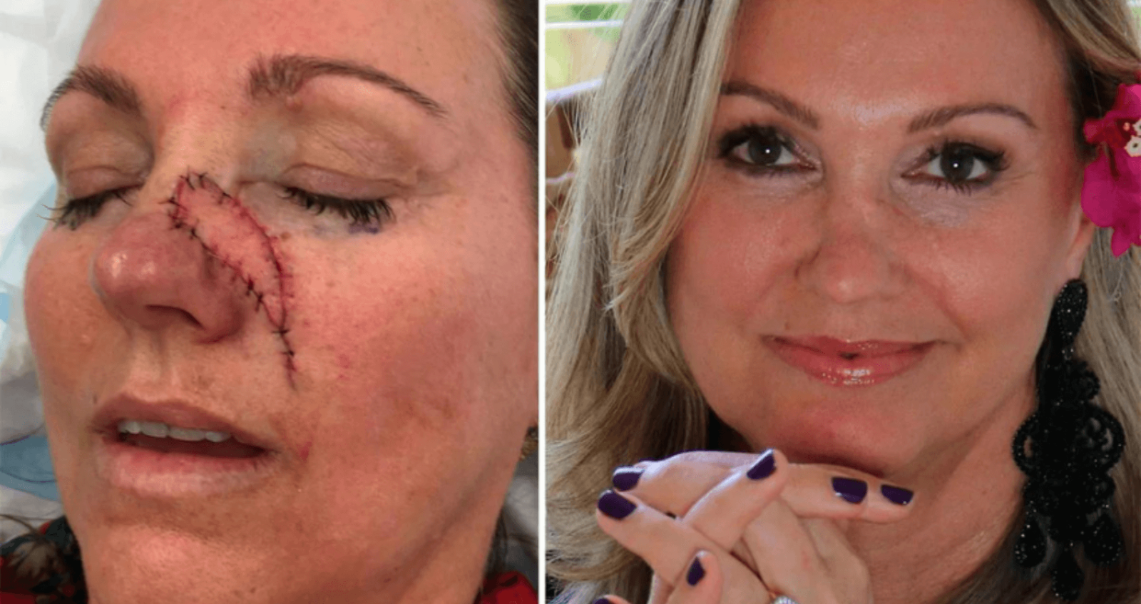 Glory Oil Before and After​