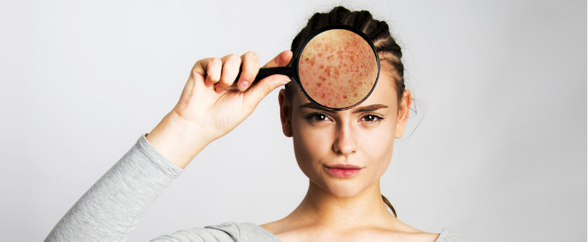 Guide to natural products for oily and combination skin