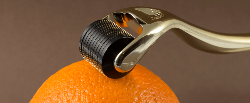 A comprehensive guide to dermal rolling